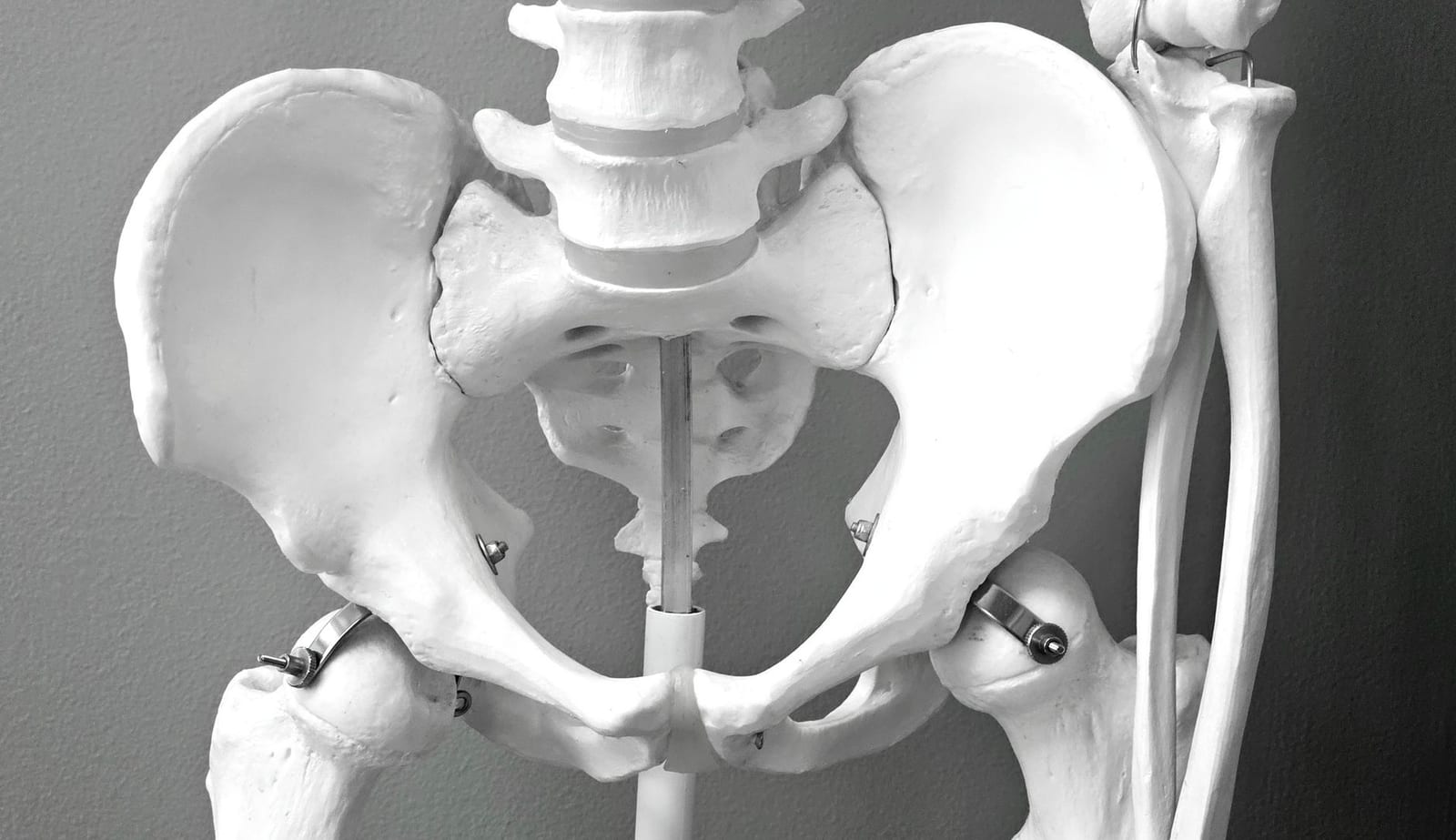 Titanium hip implant orthopedic